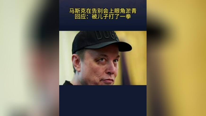 澳门最大的论坛,男子脸肿4天后意外吸住磁铁,作答解释落实的民间信仰_网红版V8.52